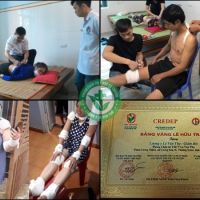 Thầy Lang Chữa Xương Khớp Ở Thanh Hóa