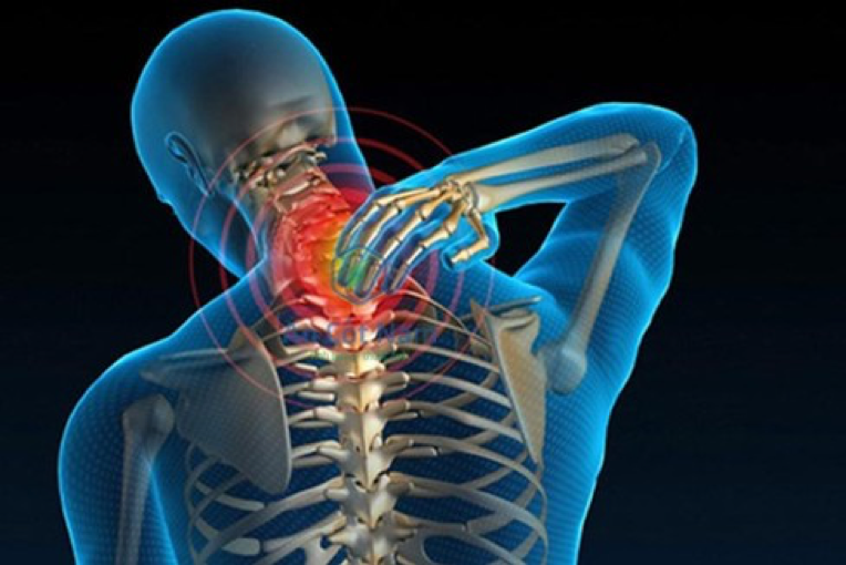 Phương pháp chữa trị căn bệnh “thoái hóa đốt sống cổ” mà bạn cần biết