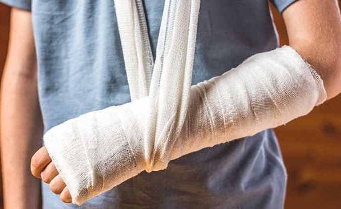 Gãy xương cẳng tay điều trị như thế nào?